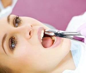 Will tooth extraction hurt
